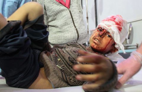 A wounded boy receives treatment in Douma following airstrikes on the village of Mesraba.