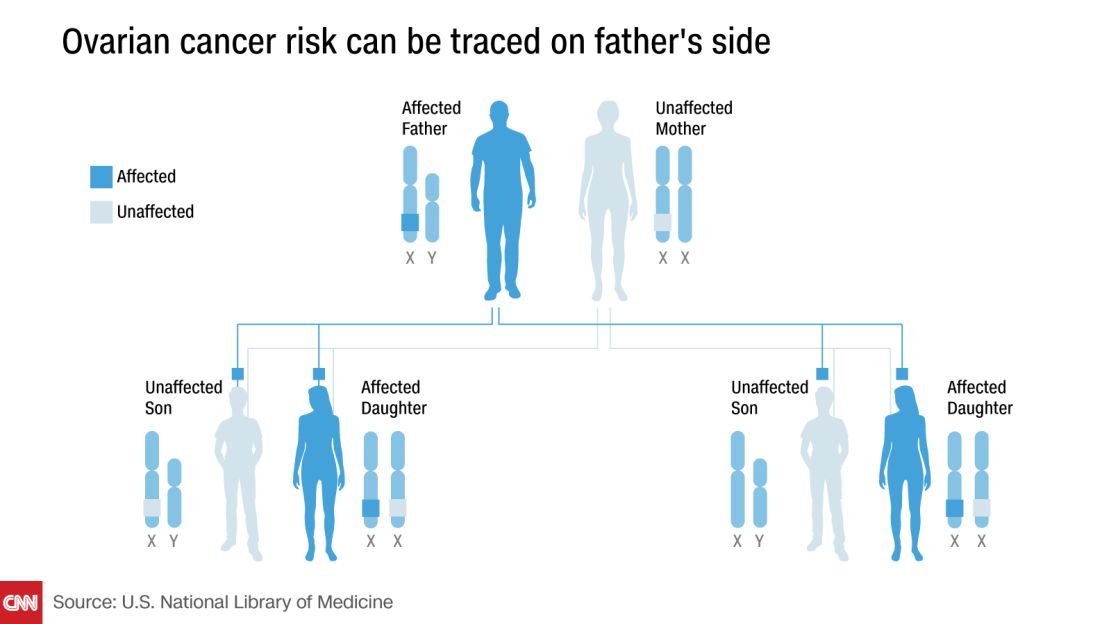 ovarian cancer chart