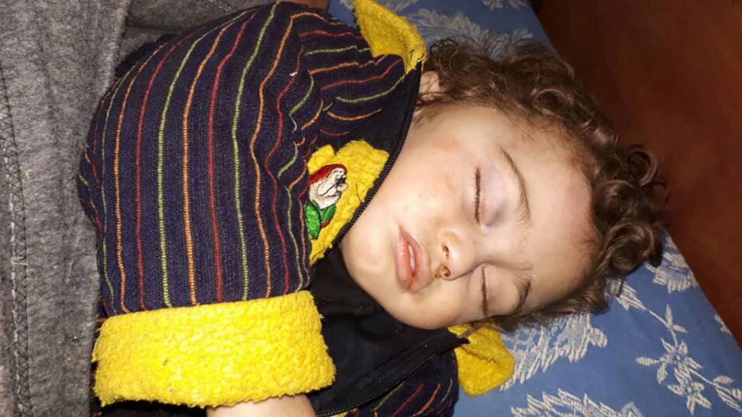 This unconscious toddler, who has been separated from his parents and whose identity is unknown, is being cared for by medical workers in Syria's besieged Eastern Ghouta.