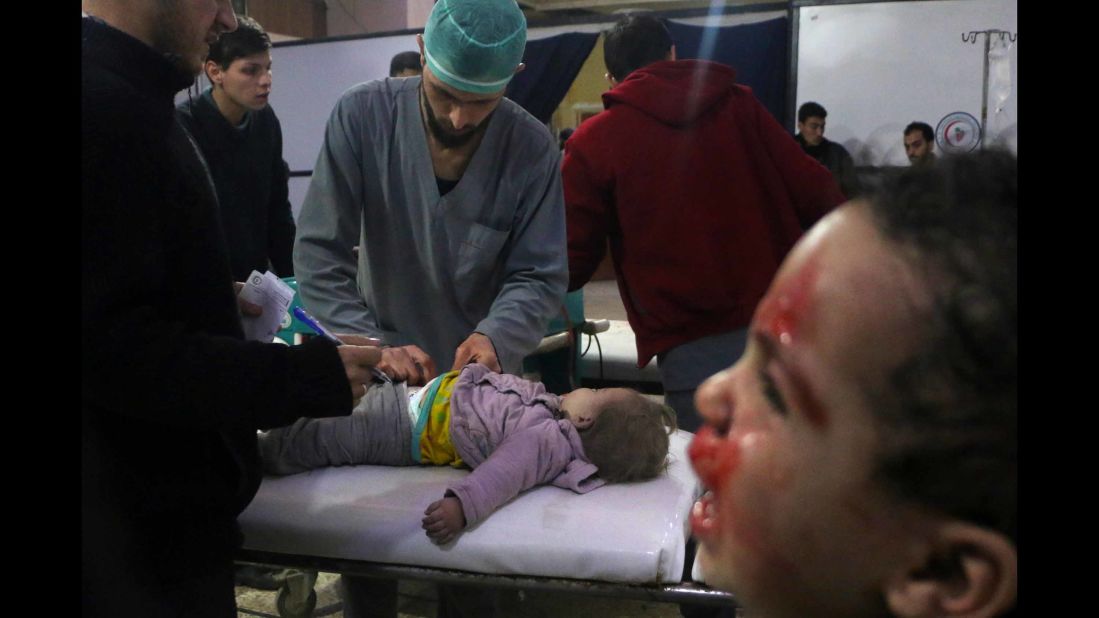 Medics tend to a baby as a child cries next to them at a makeshift clinic in Douma, Syria, on Thursday, February 23. <a href="https://www.cnn.com/2018/02/23/middleeast/syria-eastern-ghouta-bombardment-fire-rockets-intl/index.html" target="_blank">More than 400 civilians have been killed</a> this week in Syria's rebel-held Eastern Ghouta region, according to the head of the region's health department on Friday, February 23. Syrian regime forces have been pounding Eastern Ghouta with shells, mortars and bombs. 