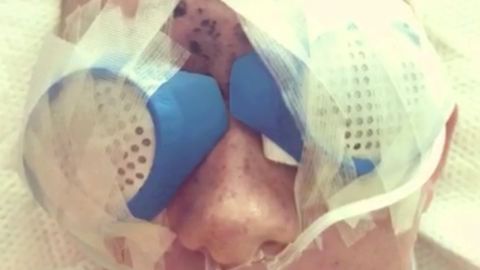 Chelsea Romo feared she had lost both eyes in the Las Vegas shooting.
