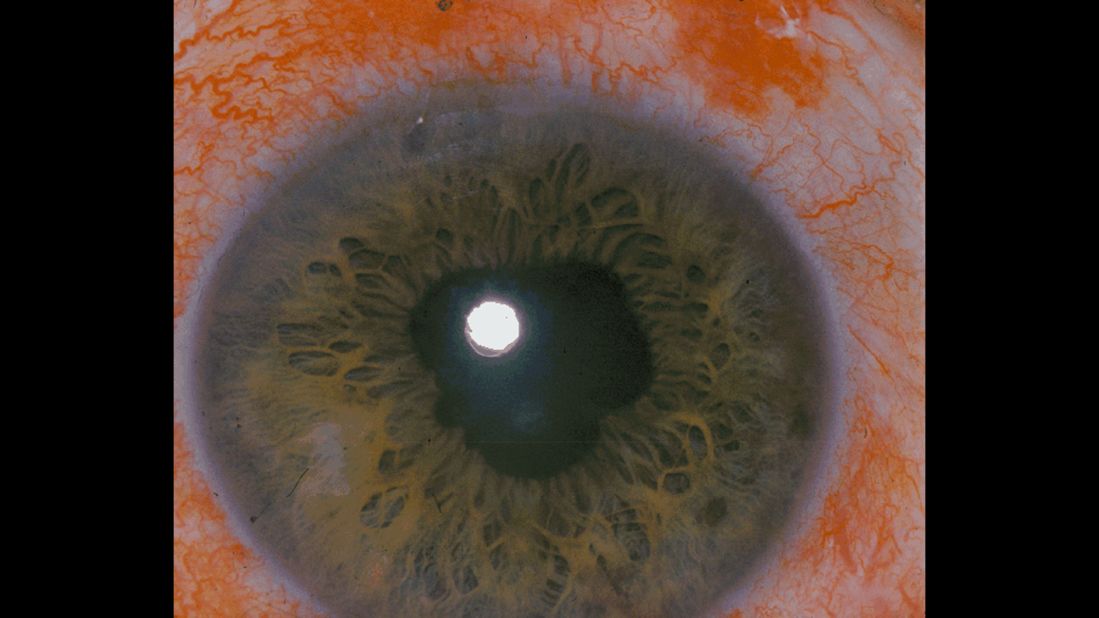 Extreme closeup of blue human eyeball showing the macula - Your Health