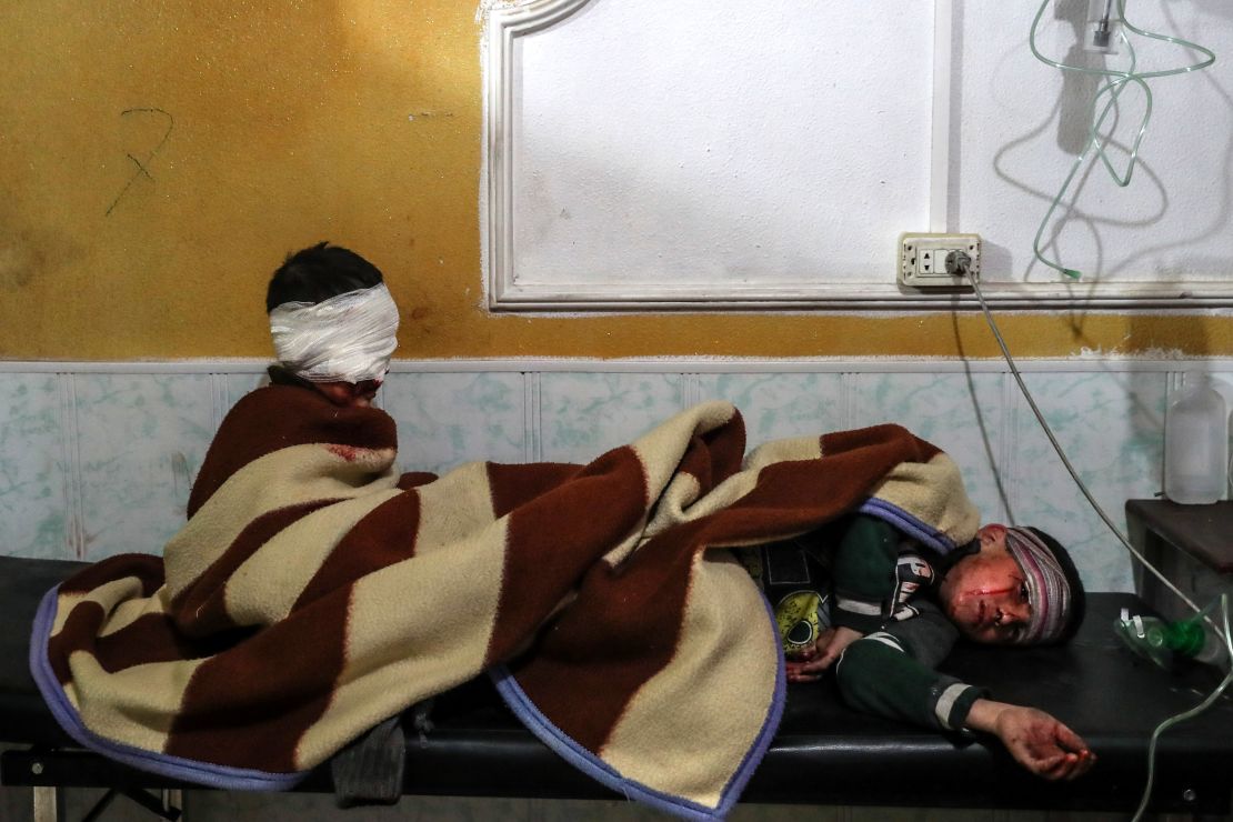 Injured children rest at a hospital in Douma.