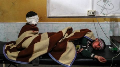 Injured children rest at a hospital in Douma.