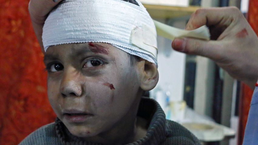 Syrian child Hossam Hawari, 8, is treated from a shrapnel wound at a makeshift clinic in Kafr Batna following Syrian government air strikes on rebel-held areas in the Eastern Ghouta region on the outskirts of the capital Damascus on March 6, 2018. / AFP PHOTO / Mohammed EYAD        (Photo credit should read MOHAMMED EYAD/AFP/Getty Images)