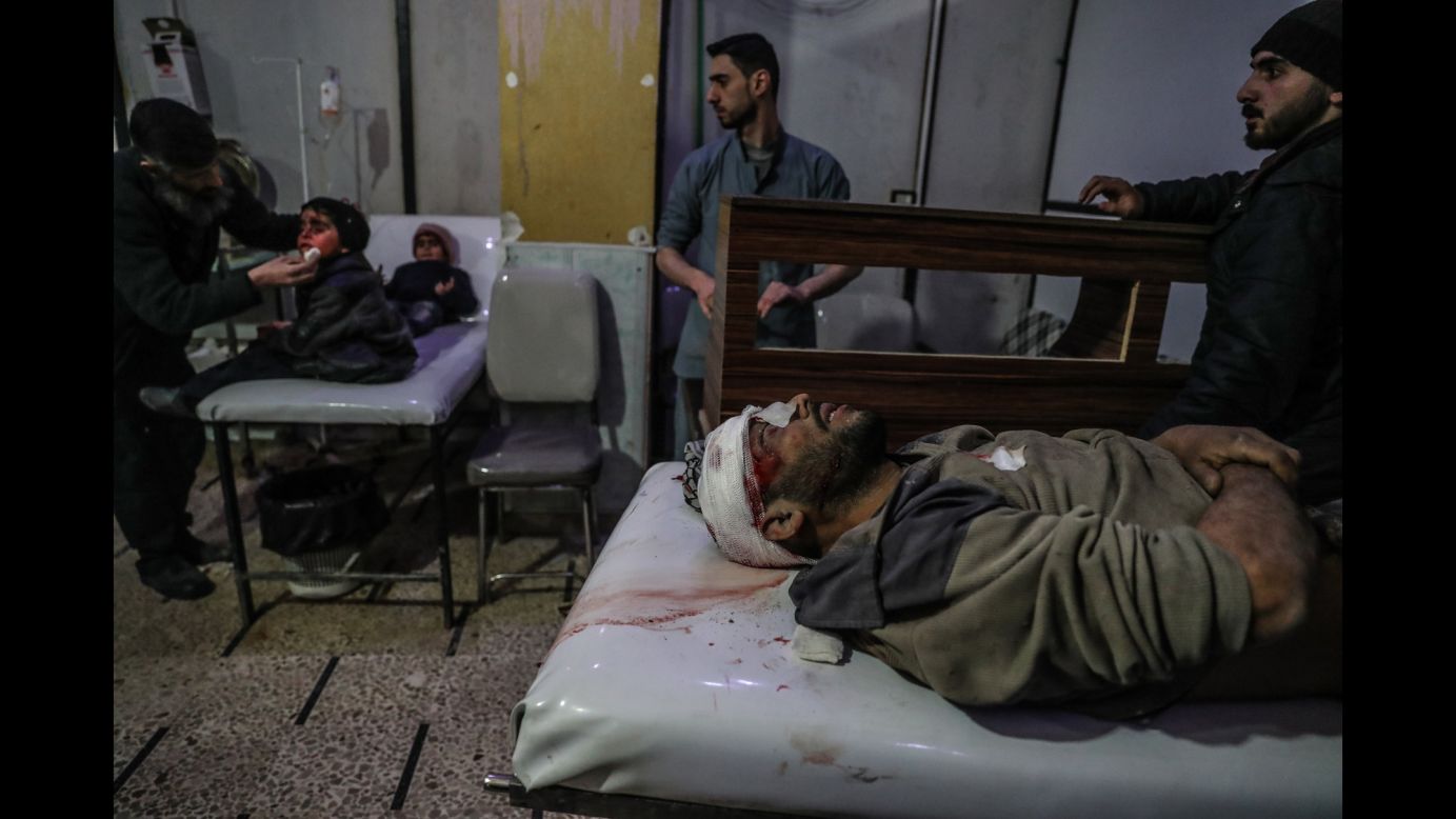 People injured in shelling are treated a hospital in Douma, Syria, on Saturday, March 3. Since February 18, <a href="http://www.cnn.com/interactive/2018/03/world/syria-eastern-ghouta-cnnphotos/" target="_blank">the Syrian regime has intensified its bombing of Douma and other cities in Eastern Ghouta,</a> one of the last rebel-controlled areas of the country.