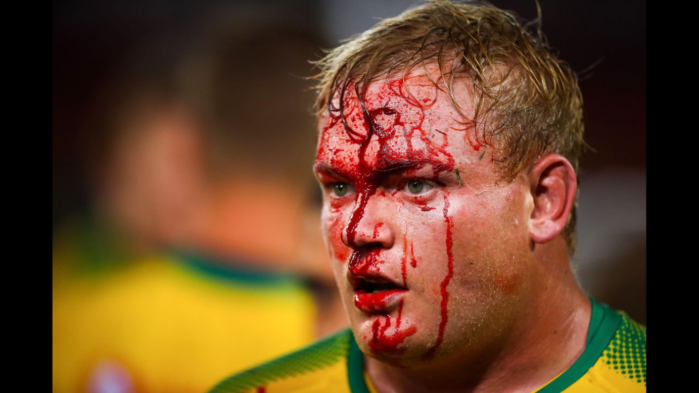 Blood runs down the face of Adriaan Strauss during a Super Rugby match in Brisbane, Australia, on Saturday, March 10.