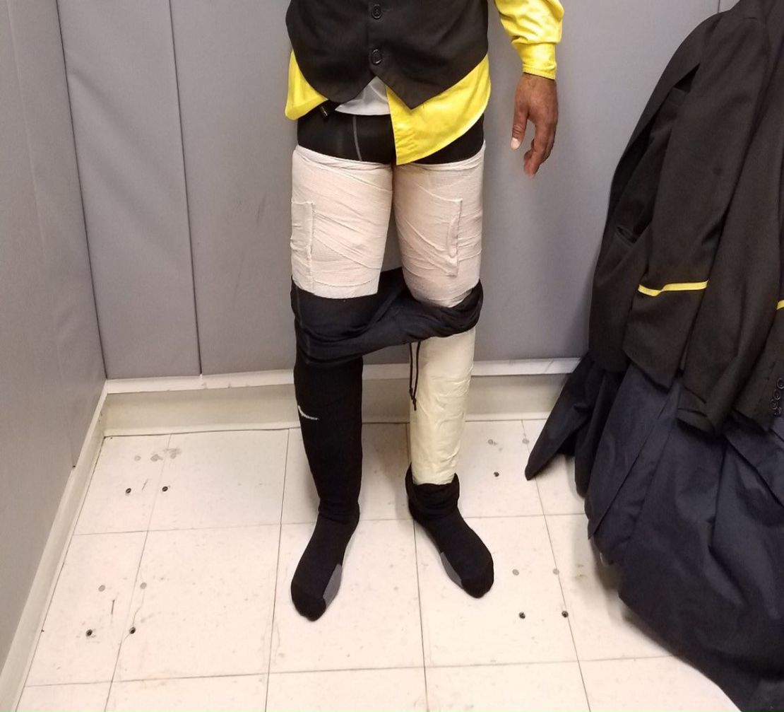 Photo from US Customs and Border Protection shows nine pounds of cocaine taped to suspect's leg 