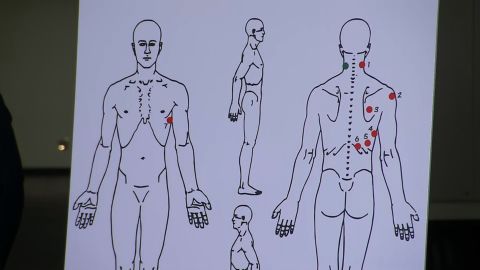 This diagram of bullet wounds on Stephon Clark's body was shown at a press conference Friday, March 30, 2018.