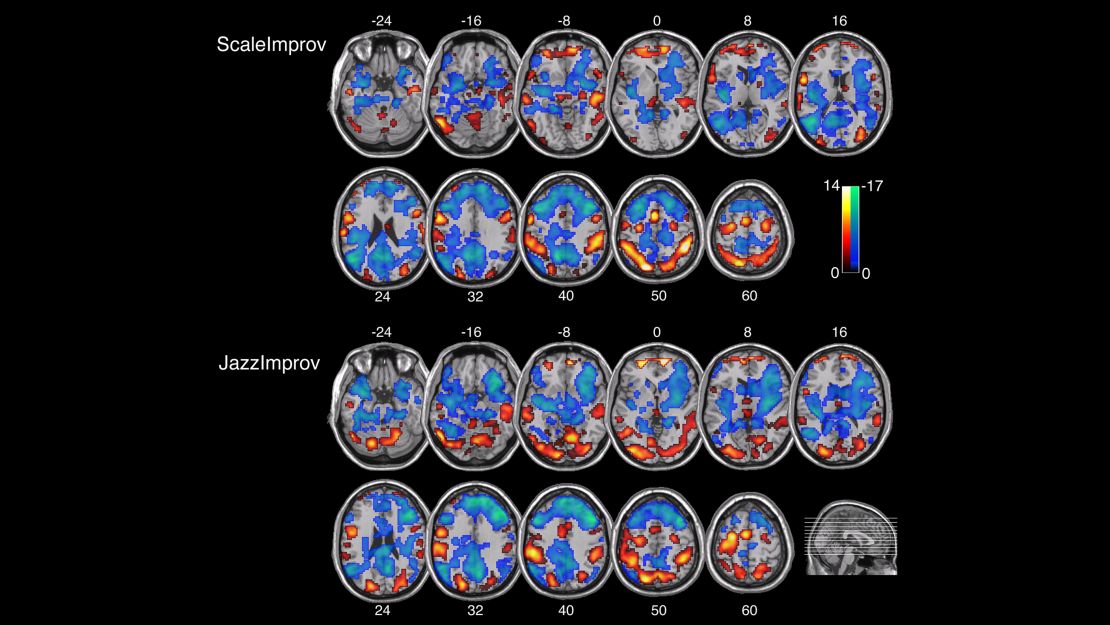 Scans of musicians' brain as they play scales vs improvisational music are shown.