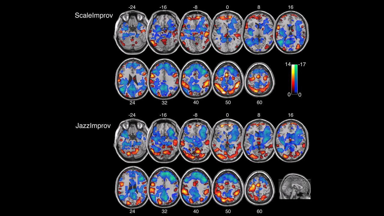 Scans of musicians' brain as they play scales vs improvisational music are shown.