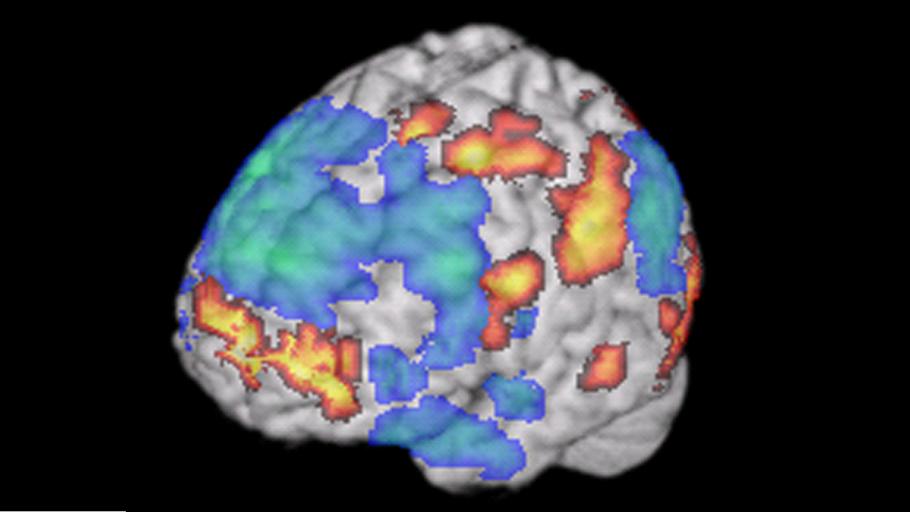 The medial prefrontal cortex, parts of the brain that allow humans to express ourselves, is shown in yellow. The part responsible for self-inhibition and control, the dorsolateral prefrontal cortex, is blue.