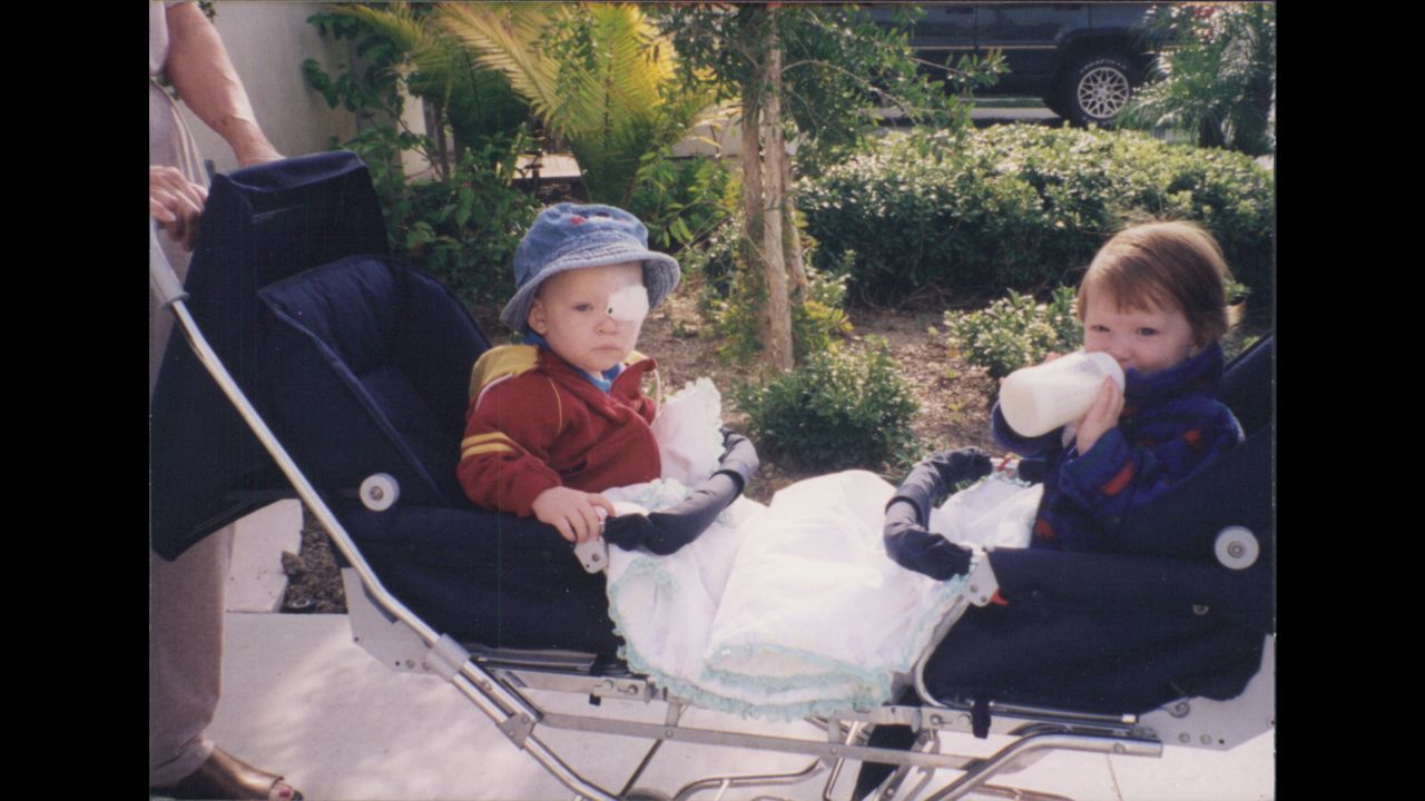 Jake Olson had his left eye removed when he was 10 months old.