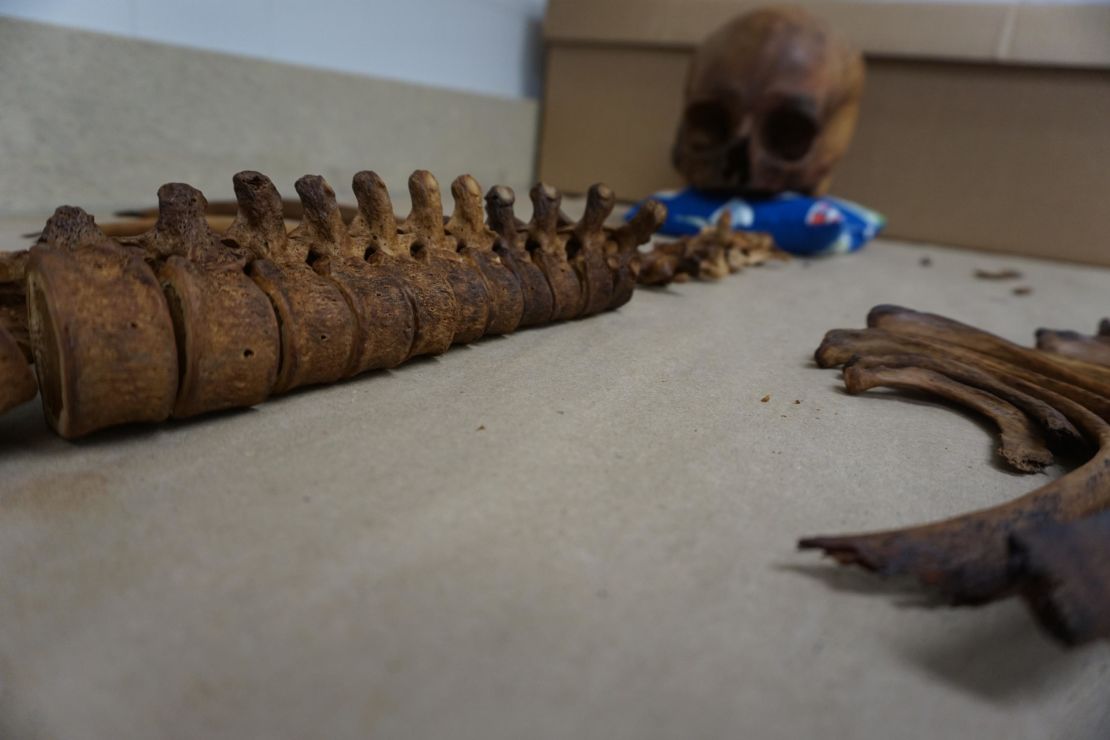 An unidentified skeleton in Kate Spradley's lab in San Marcos, Texas. 