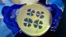 A CDC microbiologist holds a culture plate that demonstrates the modified Hodge test, which is used to identify resistance in bacteria known as Enterobacteriaceae. Bacteria that are resistant to carbapenems, considered last resort antibiotics, produce a distinctive clover-leaf shape.