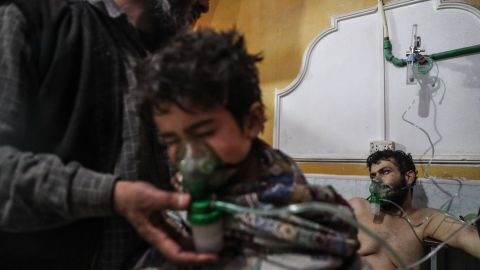 A child receives medical treatment after a village was attacked in the rebel-held Eastern Ghouta region on February 25, 2018. Several people were treated for exposure to chlorine gas, opposition groups said, as airstrikes and artillery fire from the regime continued. CNN was unable to independently verify claims that chlorine was used as a weapon.