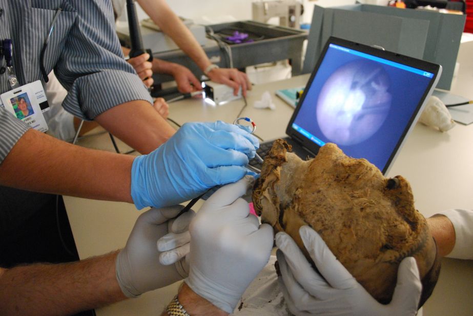 For years archaeologists had puzzled over whether the mummy's head belonged to husband or wife. The Boston Museum of Fine Arts, in possession of the entire contents of the tomb, sent it out for analysis. In 2009, doctors from the Massachusetts General Hospital extracted a tooth from the mummified head. 