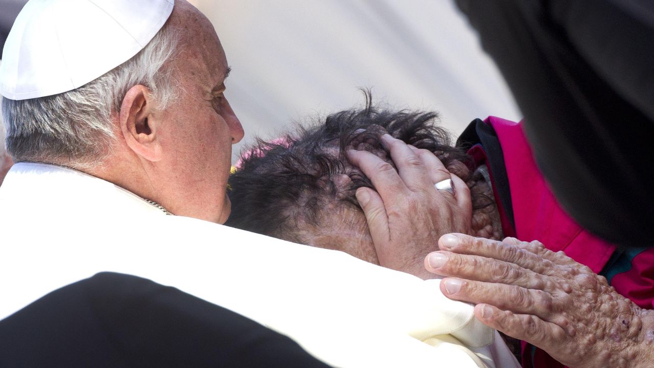 Millions were moved when Francis embraced a disfigured man in 2013.