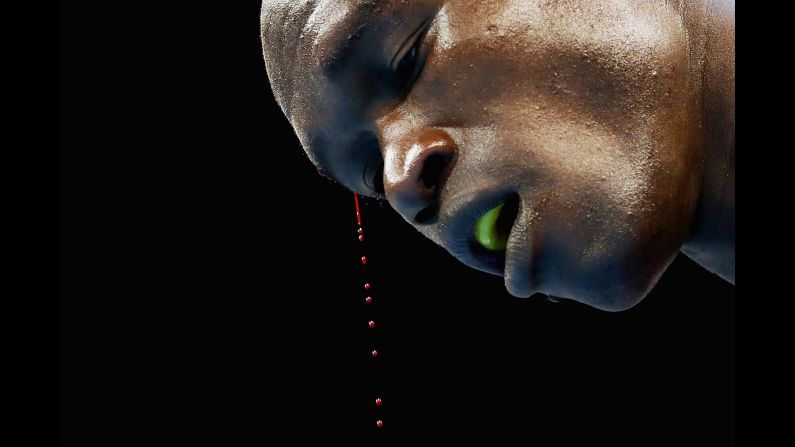 Blood drips from the head of Kenyan boxer Nicholas Okoth during the Commonwealth Games on Thursday, April 5.