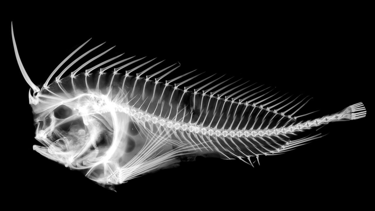 An X-ray of a Whiskered Prowfish, a kind of stonefish