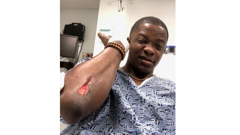 James Shaw Jr., 29, took a selfie of himself Sunday showing an injury as well as a bandaged hand. Shaw was able to wrestle an AR-15 style rifle away from the shooter. 