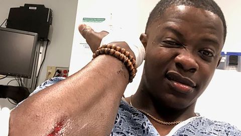 James Shaw Jr., 29, shows one of the injuries he suffered after ambushing the gunman.