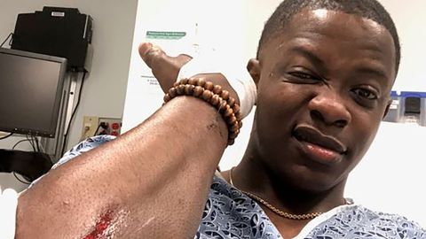 James Shaw Jr., 29, shows one of the injuries he suffered after ambushing the gunman.