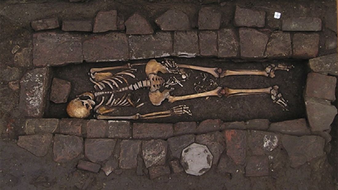 The skeleton of a young woman and her fetus were found in a brick coffin dated to medieval Italy. Her skull shows an example of neurosurgery, and her child was extruded after death in a rare "coffin birth."