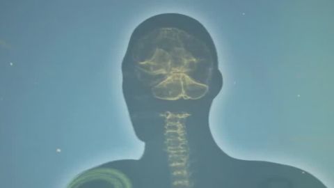 this is your brain on pain health orig_00001025.jpg