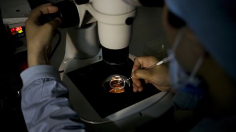 A medical staff member collects an egg on a laboratory dish during an infertility treatment through in vitro fertilization for a patient at a hospital in Beijing. 