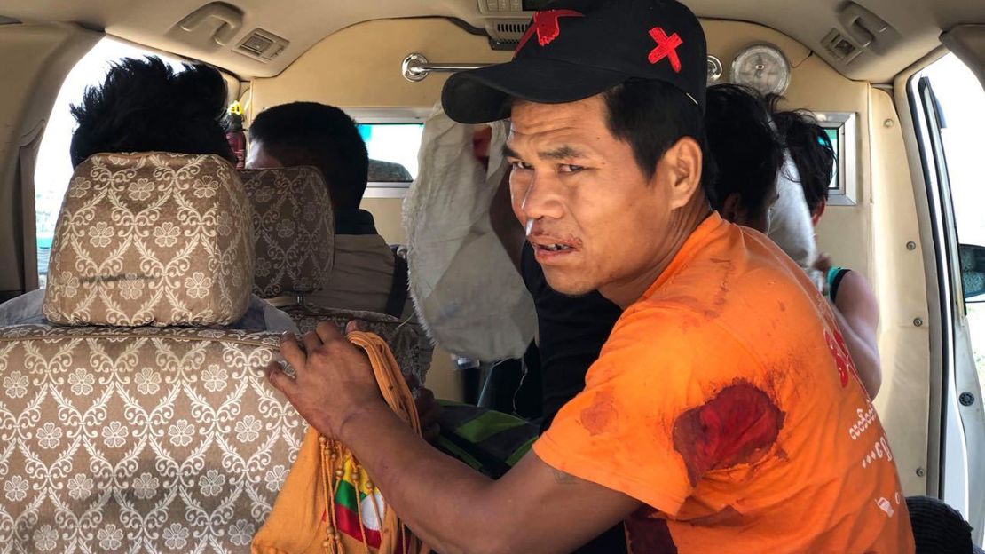 An injured man sits inside a vehicle on May 12, 2018, in Muse, northern Shan State, Myanmar, where officials say an ethnic rebel group launched an attack.
