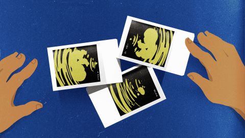 Ultrasound Depression Illustration 051418 RESTRICTED