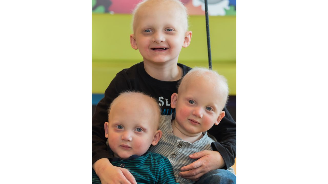 Twins Linus, left, and Maarten have more sweat glands and tooth precursors than their older brother Joshua, 5, after being treated with a drug in utero.
