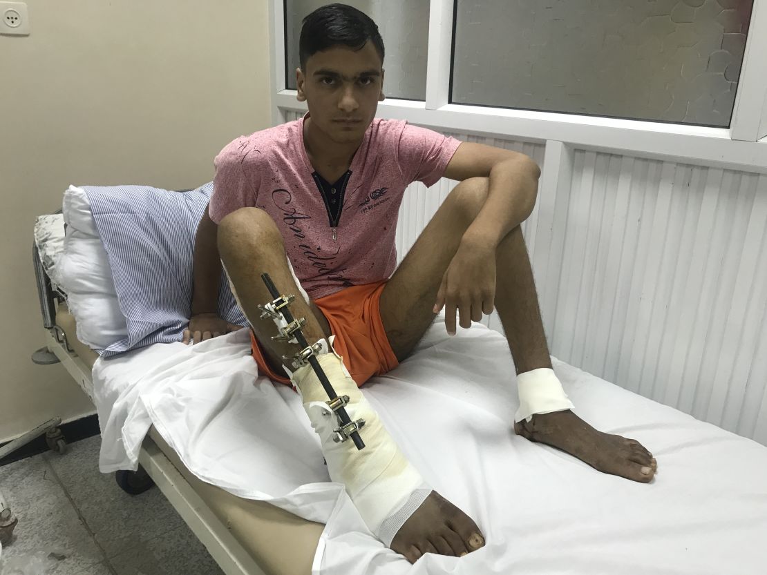 Maddah, 18, is being treated for a bullet wound to the leg.