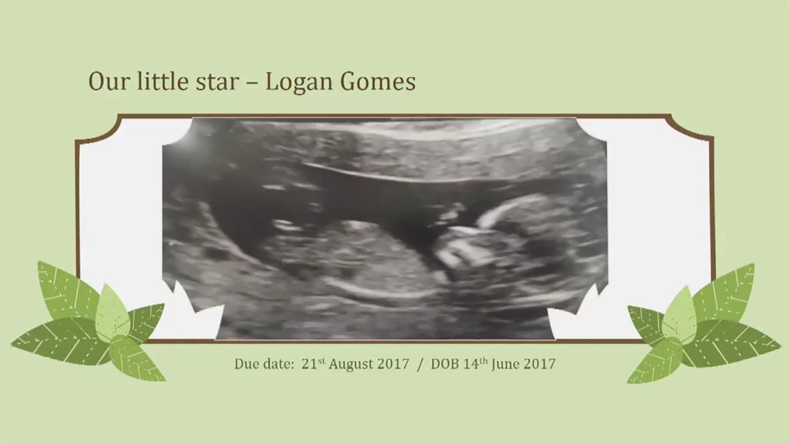 Gomes shared a picture of a scan showing his unborn baby. 