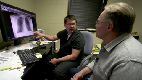 Kenny Fleming, who was diagnosed with black lung disease three years ago, looks at an image of his lung.