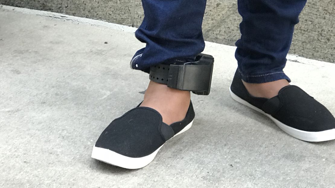 An undocumented woman wears an  ankle bracelet monitor fitted by ICE. 