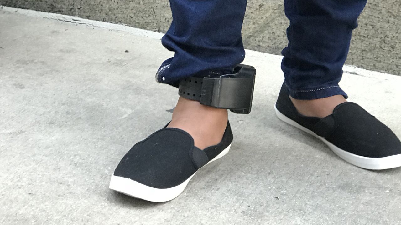 An undocumented woman wears an ankle bracelet monitor fitted by ICE.