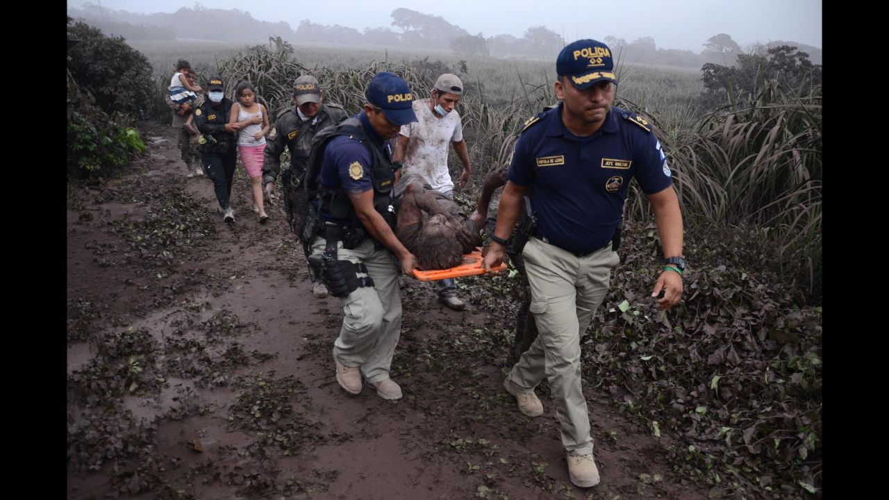 Police officers carry a wounded man in the Guatemalan village of El Rodeo after the <a href="https://www.cnn.com/2018/06/03/americas/gallery/guatemala-volcano/index.html" target="_blank">eruption of the Fuego volcano</a> on Sunday, June 3. Dozens of people were killed. 