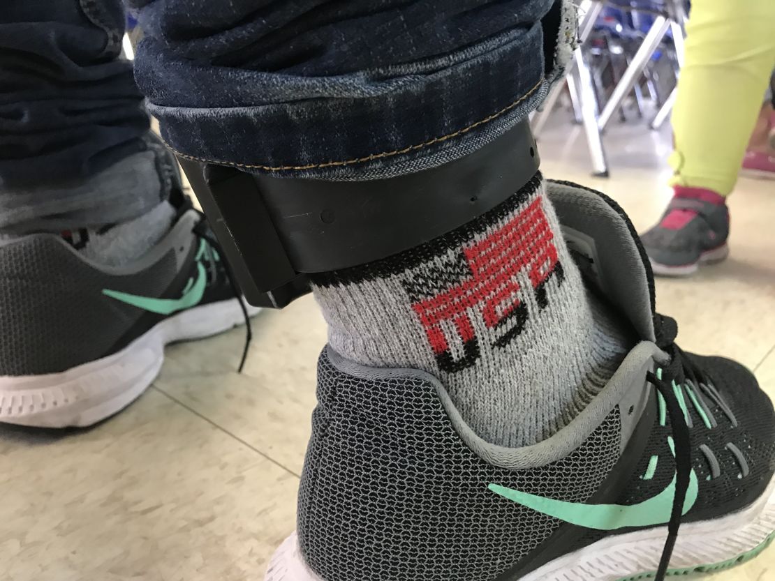An undocumented immigrant from Guatemala who came to the US illegally wears a GPS ankle monitor.