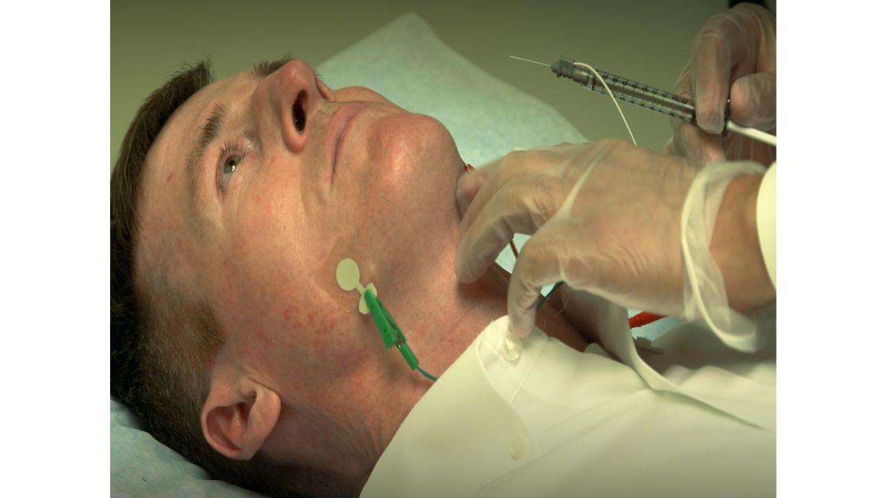 To target the tongue, the injection is given via the neck, just under the jaw.