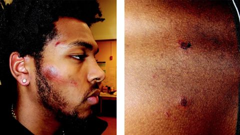 Photos included in the lawsuit show the injuries Brown allegedly suffered at the hands of police. 