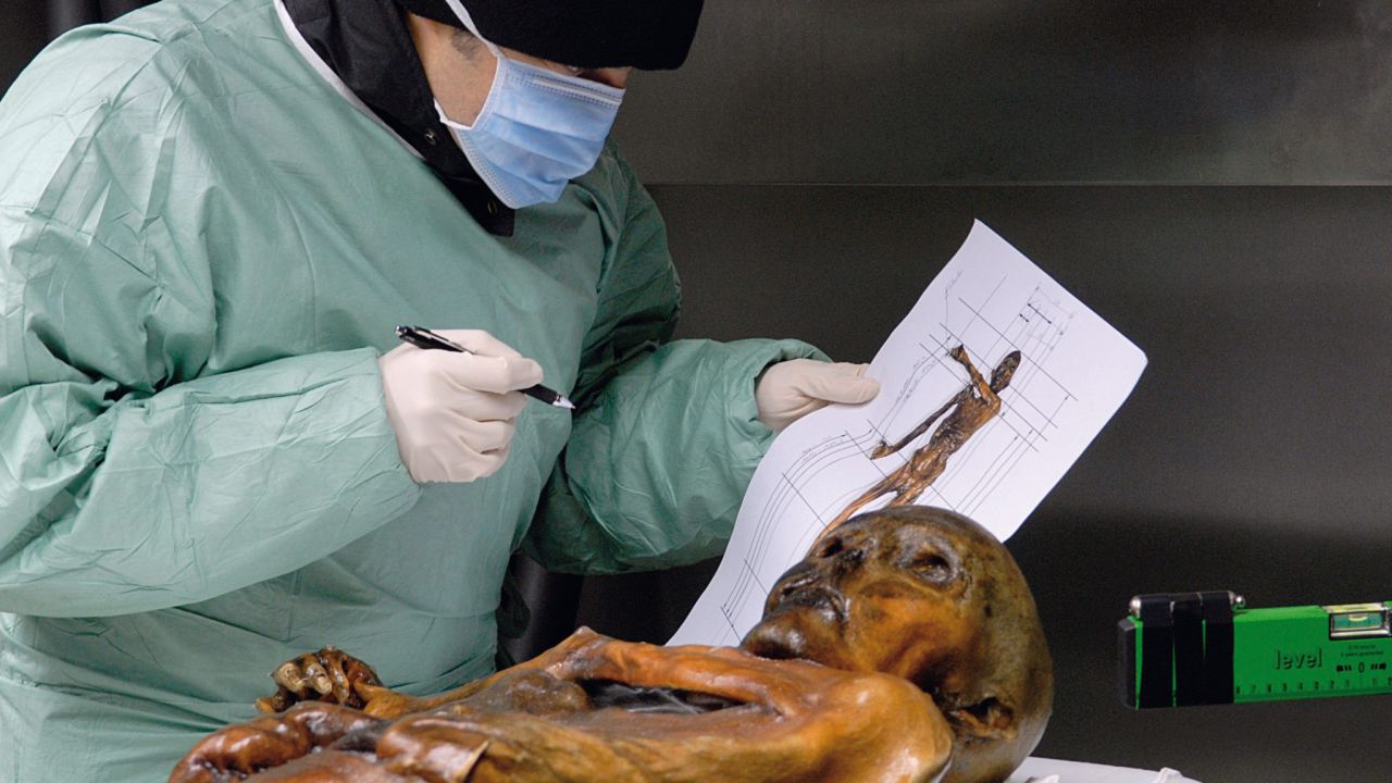 Otzi is an incredibly well-preserved glacier mummy that's 5,300 years old.