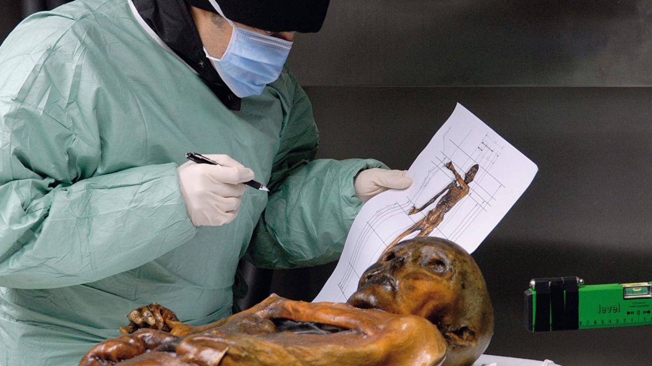 Otzi the Iceman is an incredibly well-preserved glacier mummy.