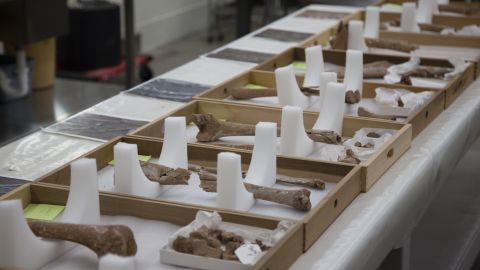 The remains of amputated limbs found at a Virginia battlefield are examined at the Smithsonian Institution.