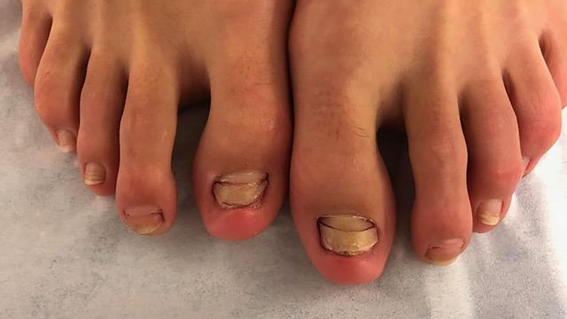 Tiny Hand And Feet Manicures Are A Thing And People Are Horrified