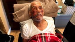 Rodolfo Rodriguez of Mexico told CNN he was visiting family in The Willowbrook neighborhood of Los Angeles when he was attacked by a woman.  A witness says she saw a woman beating Rodriguez with a small concrete block she held in her hand. His nephew says he suffered a broken jaw, broken cheek, two broken ribs and countless bruises.