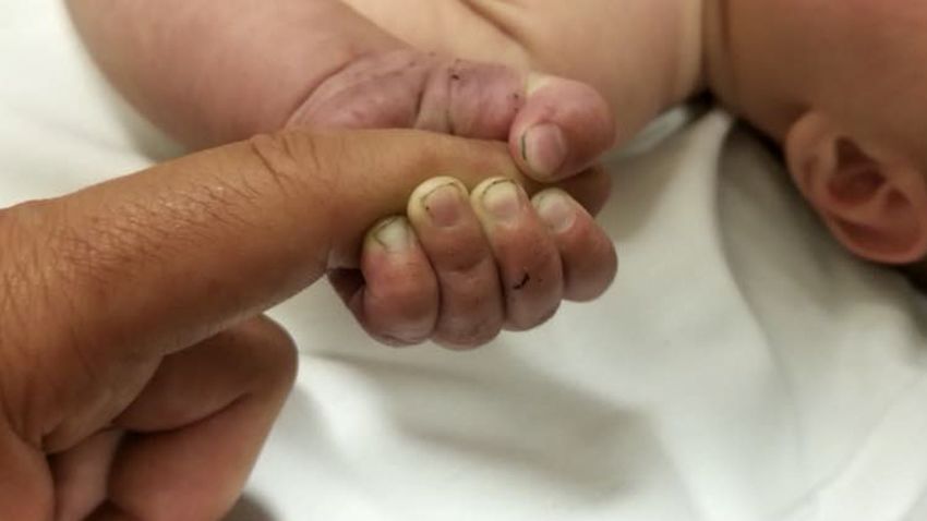 In this July 8, 2018 photo provided by the Missoula County Sheriff's Office shows a 5-month-old infant with dirt under their fingernails after authorities say the baby survived about nine hours being buried under sticks and debris in the woods.
