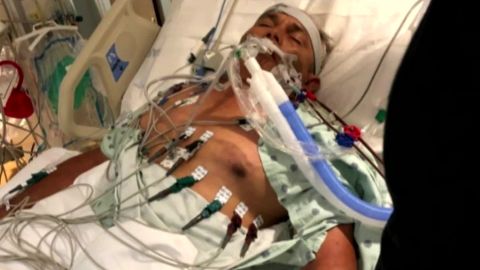 Angel Perez, 60, picked up a severe infection while crabbing and was hospitalized in Camden, New Jersey, CNN affiliate KYW reports.