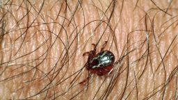Dermacentor Variabilis, also known as the American dog tick. MyLoupe/UIG/Getty Images